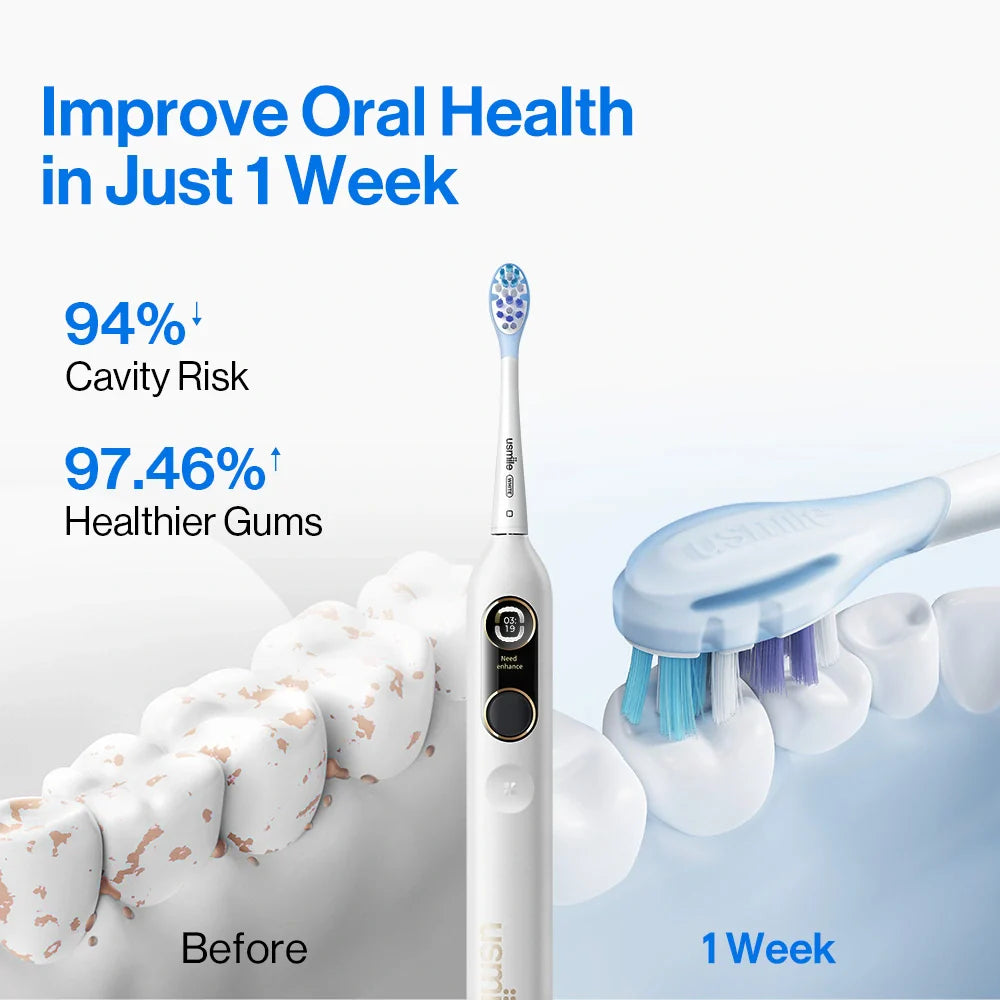 usmile Y10 PRO Brosse à dents électrique avec guidage des zones oubliées